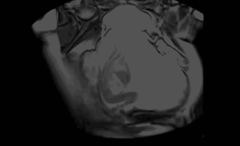 动漫 卡通 漫画 头像 481_293 gif 动态图 动图