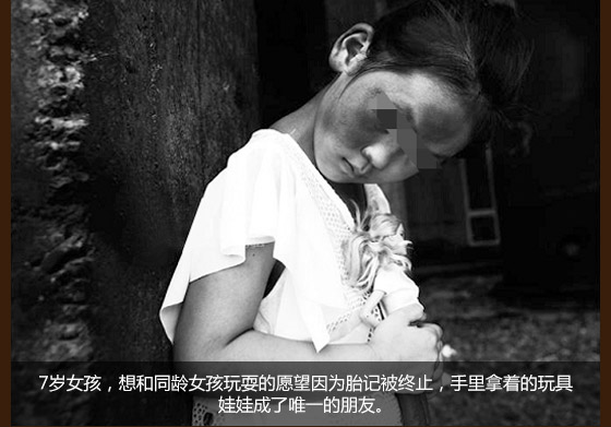 上海胎记医院-上海虹桥医院胎记公益援助
