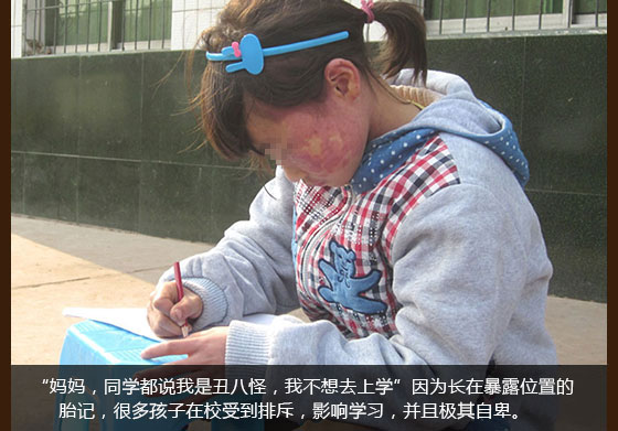 上海胎记医院-上海虹桥医院胎记公益援助